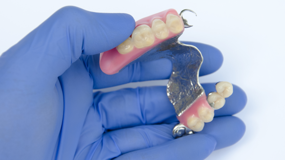  Implanty zębów – cały zestaw implantów dentystycznych 